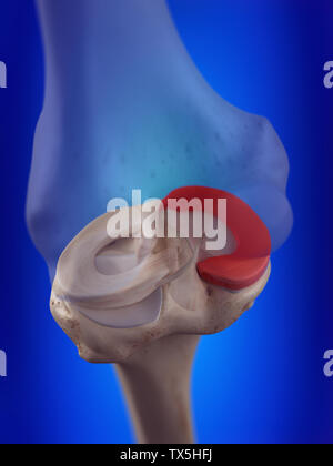 Médicalement, rendu 3d illustration précise du ménisque interne Banque D'Images