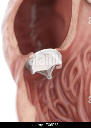 Médicalement en rendu 3d illustration d'un précis de valvule cardiaque artificielle Banque D'Images