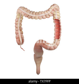 Médicalement en rendu 3d illustration précise de l'intérieur du colon Banque D'Images