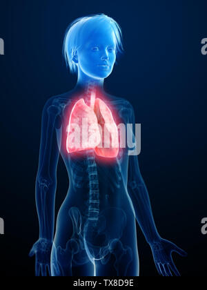 Médicalement en rendu 3d illustration d'une inflammation des poumons Banque D'Images