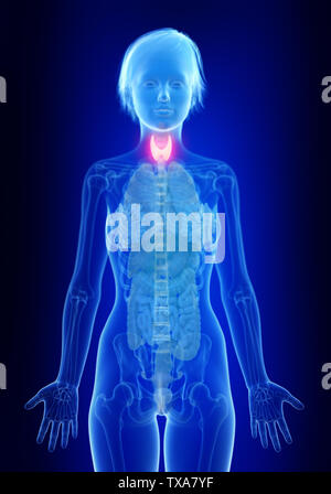 Rendu 3D précis médicalement illustration d'une inflammation de la glande thyroïde Banque D'Images