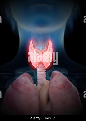 Rendu 3D précis médicalement illustration d'une inflammation de la glande thyroïde Banque D'Images