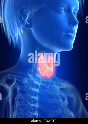 Rendu 3D précis médicalement illustration d'une thyroïde enflammée Banque D'Images