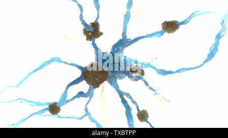 Médicalement en rendu 3d illustration précise de plaques amyloïdes sur une cellule nerveuse - la maladie d'alzheimer Banque D'Images