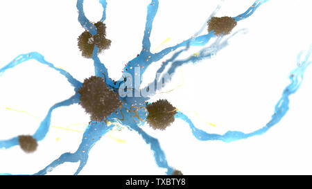 Médicalement en rendu 3d illustration précise de plaques amyloïdes sur une cellule nerveuse - la maladie d'alzheimer Banque D'Images