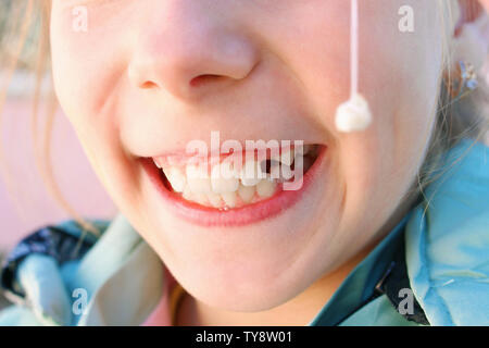 Dent de lait de l'enfant sortit avec filetage. Banque D'Images