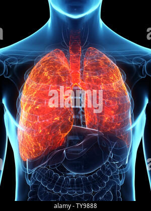 Médicalement en rendu 3d illustration d'un précis poumon malade Banque D'Images