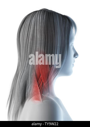 Médicalement en rendu 3d illustration d'un précis des muscles du cou chez les femmes Banque D'Images