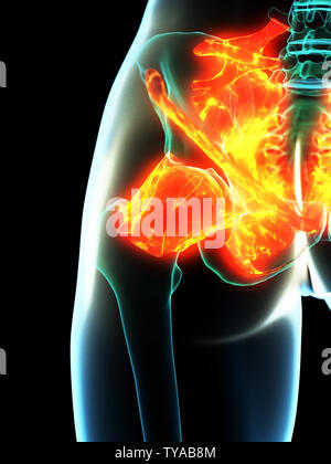 Médicalement en rendu 3d illustration de l'inflammation des ligaments précis Banque D'Images