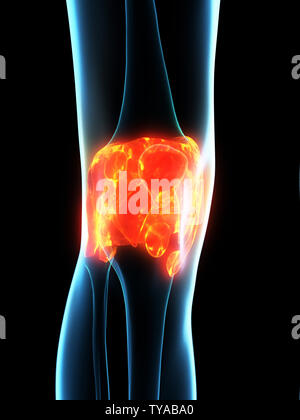 Médicalement en rendu 3d illustration de l'inflammation des ligaments précis Banque D'Images