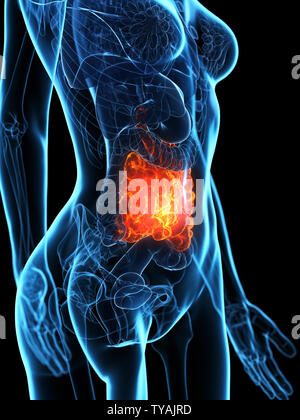 Médicalement en rendu 3d illustration d'un précis de l'intestin grêle maladies Banque D'Images
