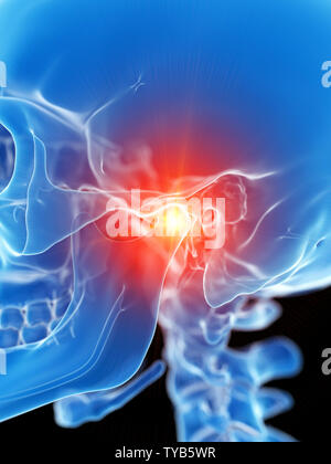 Médicalement en rendu 3d illustration de l'temporomandibuar précis montrant la douleur commune Banque D'Images