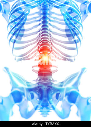 Médicalement en rendu 3d illustration précise de la colonne lombaire montrant la douleur Banque D'Images