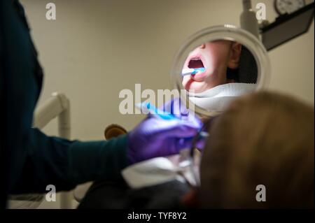 Channing Wray, est titulaire d'un miroir pour regarder son dentiste nettoie ses dents pendant la "Petite Dents, grand sourire" événement à base aérienne de Ramstein, en Allemagne, le 5 novembre 2016. L'événement a été un moyen pour les enfants de moins de 10 ans pour obtenir leurs dents vérifié ou nettoyé dans un environnement adapté à leur âge. Selon le Center for Disease Control et, d'une carie est l'une des maladies chroniques les plus fréquentes de l'enfance aux États-Unis. Les caries non traitées peuvent causer de la douleur et des infections qui peuvent conduire à des difficultés à manger, parler, jouer, et l'apprentissage. Banque D'Images