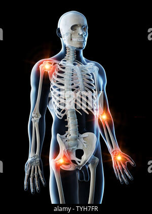 Rendu 3d illustration d'un mans joints douloureux Banque D'Images