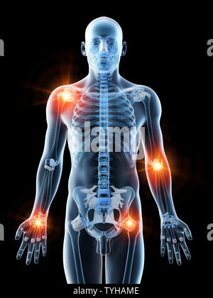 Rendu 3d illustration d'un mans joints douloureux Banque D'Images