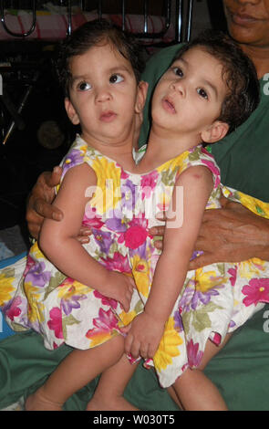 One-year-old jumeaux siamois Stuti et Aradhna apparaissent à un hôpital à Betul, Madhya Pradesh, Inde le 19 juin 2012. Les jumeaux, qui ont été jointes à la poitrine, ont été séparés hier à 12 heures d'opération impliquant 23 médecins et 11 infirmières de l'Inde et l'Australie. . UPI/ Str.. Banque D'Images