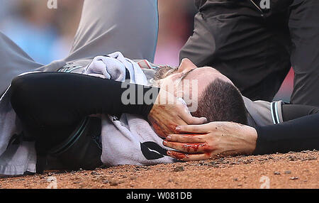 Le lanceur partant Arizona Diamondbacks Robbie Ray occupe la tête après avoir été frappé à la tête par une ligne de route le départ de Saint Louis Cardinals Luc voit dans la deuxième manche au Busch Stadium de Saint-Louis Le 28 juillet 2017. Ray a été prise hors du terrain par panier et transportés dans un hôpital local. Photo de Bill Greenblatt/UPI Banque D'Images