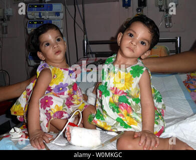 Anciennement jumeaux siamois, Stuti (L) et Aradhana sont assis côte à côte à l'hôpital missionnaire en Padhar, Betul, centre de l'Inde le 28 juin 2012. L'âgés d'un an ont été séparés avec succès après une chirurgie de 12 heures le 20 juin, menée par une équipe de 34 experts médicaux, dont 23 médecins, tirées de l'Inde et à l'étranger.Le one-year-old sœurs étaient réunies à cœur et le foie. UPI Photo/ STR. Banque D'Images