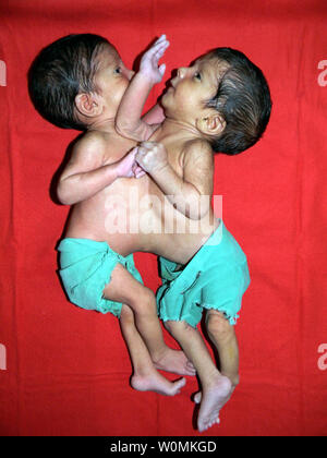 Anciennement jumeaux siamois, Stuti et Aradhana sont vus dans cette pré-dossier de coopération à l'hôpital missionnaire photo dans Padhar, Betul, au centre de l'Inde. L'âgés d'un an ont été séparés après 12 heures d'opération le 20 juin 2012, mené par une équipe de 34 experts médicaux, dont 23 médecins, tirées de l'Inde et à l'étranger.Le one-year-old sœurs étaient réunies à cœur et le foie. UPI Photo/ STR. . Banque D'Images
