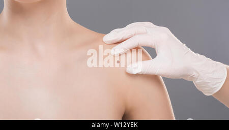 Dermatologist examining tache sur l'épaule femme, panorama Banque D'Images