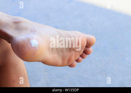 Close up homme la douleur de pied pied Séance maïs attendez docteur dans un hôpital Banque D'Images