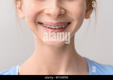 Smiling teenage girl avec appareil dentaire sur fond gris Banque D'Images