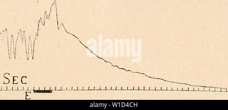 Image d'archive à partir de la page 898 du Dictionnaire de physiologie (1904). Dictionnaire de physiologie . dictionnairedeph06riche Année : 1904 FULGURATION. 889 cet animal. Les oreillettes soat arrÃªtÃes en diastole pendant quelques minutes chez le cobaye et le rat soumis au courant de 550 volts, lorsque le contact dure une ou deux secondes. iNous voyons donc que le cÅur est moins influencÃ par le courant continu le courant alternatif que par frÃquence Ã normale (40 Ã 150 pÃriodes). Toutefois, le courant continu tension ÃlevÃ Ã paraÃ®t do toujours les trÃmulations fibrillaires, mÃªme si la durÃe du Banque D'Images