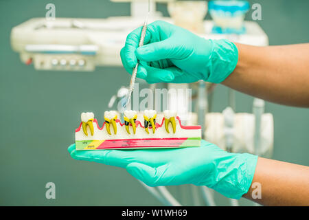 Tenir la main modèle dentaire dentiste en cabinet dentaire Banque D'Images