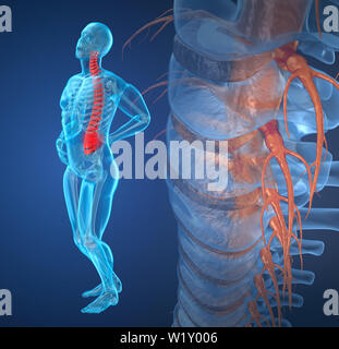 Attaque douleur rachidienne, l'homme souffrant de douleur rachidienne. 3D illustration Banque D'Images