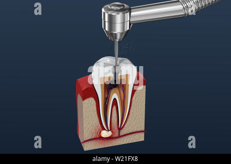 Processus de traitement de canal. 3D illustration Banque D'Images