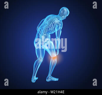 Attaque de la douleur au genou, l'homme souffrant de la moelle au genou. 3D illustration Banque D'Images