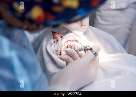 La chirurgie à la clinique dentaire. L'anesthésie en chirurgie dentaire. Banque D'Images