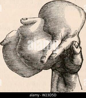 Image d'archive à partir de la page 154 de la cyclopaedia d'anatomie et de Banque D'Images