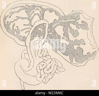Image d'archive à partir de la page 173 de la cyclopaedia d'anatomie et de Banque D'Images