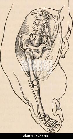 Image d'archive à partir de la page 176 de la cyclopaedia de l'anatomie et. La cyclopaedia de l'anatomie et physiologie0402cyclopdiaofana todd Année : 1849, né le long des Acephalus avec un nom d'enfant. les observations dont nous savons d'elle sont ot jumeaux, et dans un cas de trois enfants nés à une naissance. Dans de nombreux il est prouvé que la mère de l'acephalus a souvent été fecun- datée. Ils sont de taille adulte, rarement à la naissance, et qu'ils ont dans la plupart des cas d'un placenta commun à eux et l'enfant bien formé, mais avec un cordon distinct ; les membranes fœtales semblent également être communs aux deux. Le cordon de la Banque D'Images