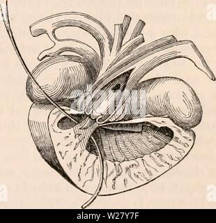 Image d'archive à partir de la page 328 de la cyclopaedia de l'anatomie et. La cyclopaedia de l'anatomie et physiologie0401cyclopdiaofana todd Année : 1847 Coeur de la tortue. {Après Bojanus.) Le ventricule a ouvert à l'avant, l'aorte gauche ouverte, et une brosse placé dans l'artère pulmonaire en taille au ventricule : ils sont divisés par une cloison, ce qui, toutefois, est perforé dans la Testudo scorpioides. Le droit reçoit le sang de l'organisme par le biais de l'venae cavae, tandis que le sang d'oxygenized les veines pulmonaires entre dans la gauche par une fissure- comme l'orifice valvulaire. L'arrangement interne de Banque D'Images