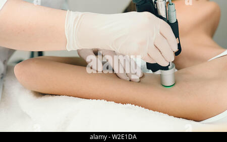 Le traitement de laser d'obtenir du patient sur l'aisselle, Close up. Suppression de cheveux de laser sur l'aisselle Banque D'Images