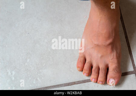 Close up de pieds avec une blessure à l'auriculaire Banque D'Images