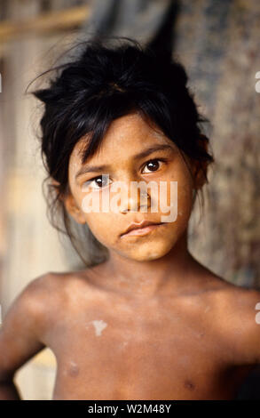 Portrait d'un enfant, un survivant de l'cyclone de 1991. Le cyclone de 1991 a été l'un des plus meurtriers sur les cyclones tropicaux qui a frappé le Bangladesh. Le cyclone a frappé le sud-est du district de Chittagong, dans la nuit du 29 avril avec des vents autour de 250 kilomètres par heure. Il y a eu une onde de tempête de 6 mètres sur une vaste zone, tuant au moins 138 000 personnes et laissant pas moins de 10 millions de sans-abri. Chittagong, Bangladesh. 1991. Source : www.wikipedia.com Banque D'Images