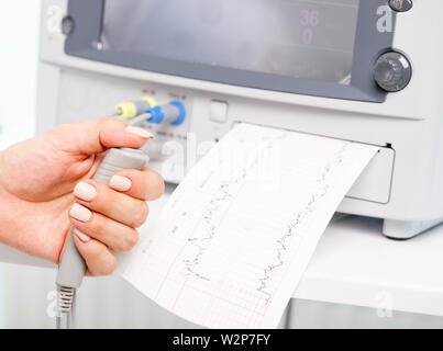 Close-up shot of pregnant woman's hand holding contrôleur de l'Cardiotocograph alias machine de monitorage électronique du foetus (EFM) enregistrement de la fetal heartb Banque D'Images