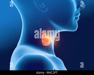 3D illustration médicale cancer de la thyroïde d'une femme, médicalement illustration sur fond bleu Banque D'Images
