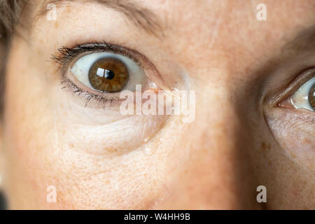 Oeil, larmes, larmoiement des yeux, Banque D'Images