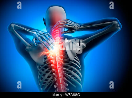 Homme avec une forte douleur dans la colonne vertébrale - 3D illustration Banque D'Images