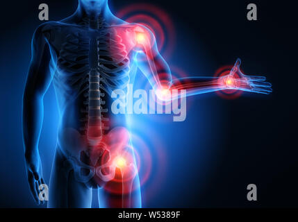 L'homme avec des joints douloureux - 3D Illustration Banque D'Images