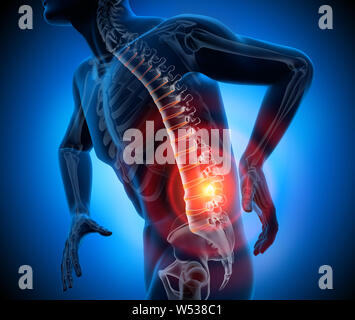 Une forte douleur dans la colonne vertébrale - 3D illustration Banque D'Images