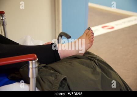 Cheville cassée : une femme avec une fracture à la cheville droite attend sur une civière dans le couloir d'un service d'urgence hospitalier Banque D'Images