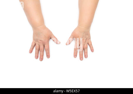 Les mains d'une femme âgée avec les rides et la peau sèche, la déshydratation, l'arrière-plan blanc, isoler, la dermatologie, la propreté Banque D'Images