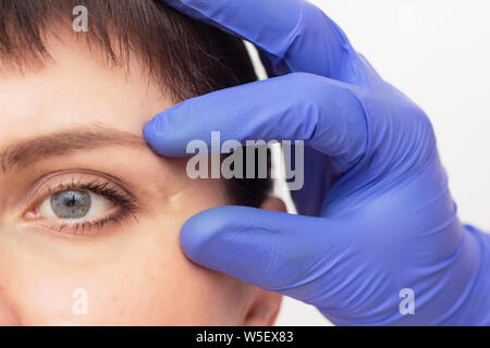 Cosmetologist médecin examine une cicatrice sur le visage de la fille, close-up, de la peau, médecin Banque D'Images