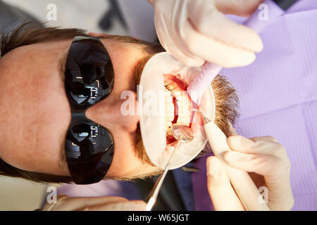 Dentiste enlève le tartre ou la carie dentaire pendant le traitement avec le foret dans le cabinet dentaire Banque D'Images